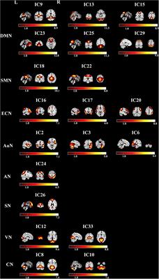 Dynamic functional connections in leukoaraiosis patients without cognitive impairment: A pilot study